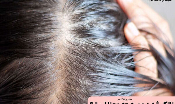 علت نازک شدن مو چیست؟ آموزش روش های تقویت و درمان نازکی مو سر