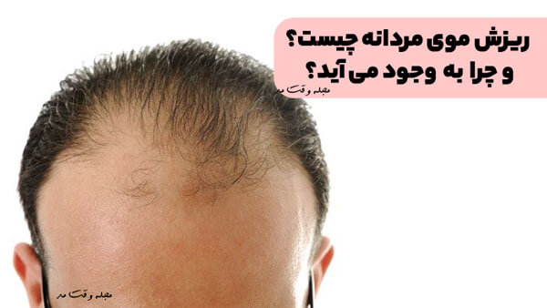 ریزش موی مردانه چیست؟ روش های علمی درمان و پیشگیری